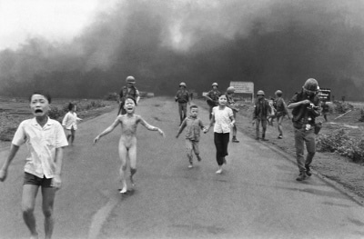 Girl burned by napalm
